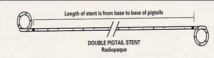 STENT004