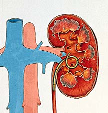 STENT005