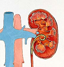 STENT006