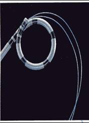 STENT007