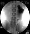 STENT008