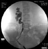 STENT009