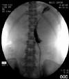STENT010