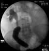 STENT013