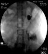 STENT015