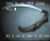STENT016