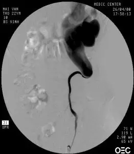 hepkn004(2)